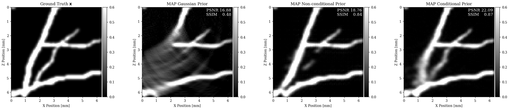 Medical Imaging with Uncertainty Quantification