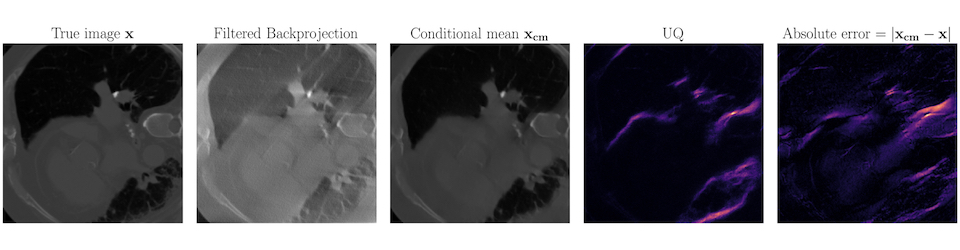 Medical Imaging with Uncertainty Quantification